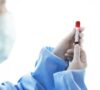 Klucz do zdrowia – badania laboratoryjne na najwyższym poziomie