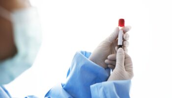 Klucz do zdrowia – badania laboratoryjne na najwyższym poziomie
